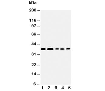 ANXA1 / Annexin A1 Antibody (aa3-24)