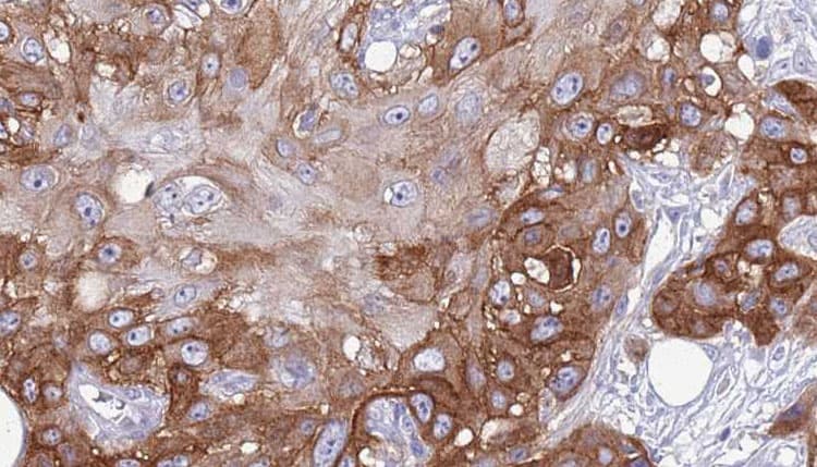 Polyclonal Rabbit anti-Human PDCD1 / CD279 / PD-1 Antibody (IHC, WB)