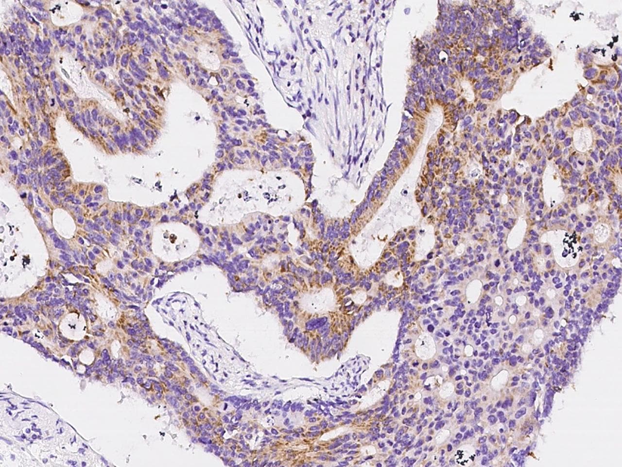 HDHD3 Antibody