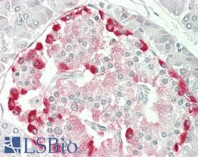IHC-plus™ TSG101 Antibody