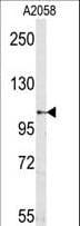 SEMA5A / Semaphorin 5A Antibody (N-Terminus)