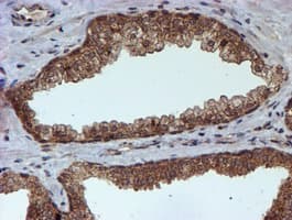 HARS2 Antibody (clone OTI5H2)