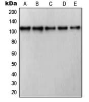 RB1 / Retinoblastoma / RB Antibody (C-Terminus)