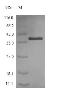 Acinetobacter baumannii omp38 Protein (Recombinant 6His, N-terminus)