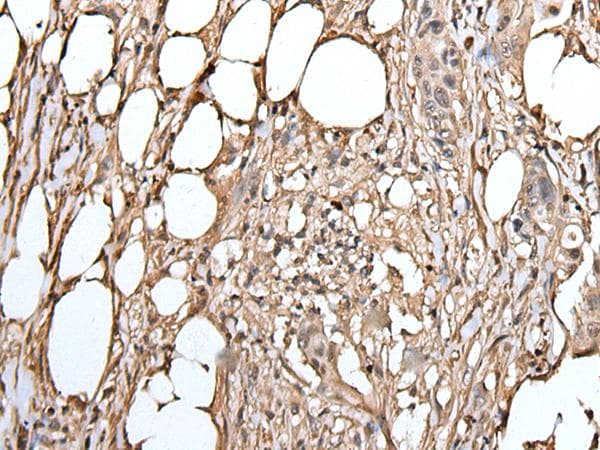 ATAD1 Antibody