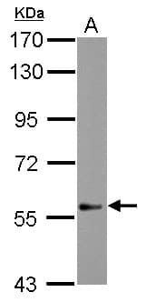 IHC-plus™ Polyclonal Rabbit anti-Human NUDR / DEAF1 Antibody (Internal, IHC, WB)