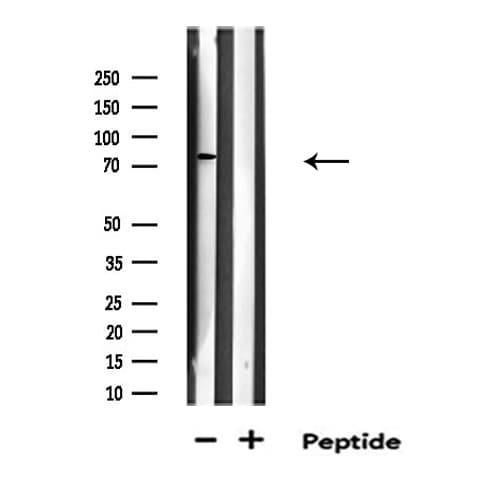 Polyclonal Rabbit anti-Human RFWD2 / COP1 Antibody (IF, WB)