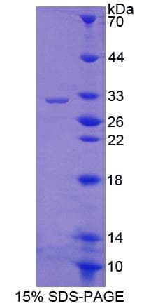 Rat MAP3K12 Protein (Recombinant His, N-Terminal)