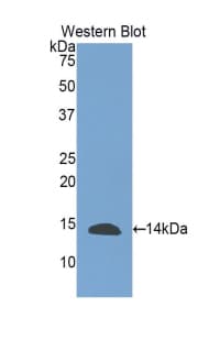 INHBE / Activin Antibody (aa237-350)
