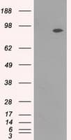 Monoclonal Mouse anti-Human NTRK3 / TRKC Antibody (clone OTI4E10, IHC, IF, WB)