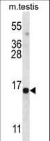 Polyclonal Rabbit anti-Human SPATA19 Antibody (aa122-150, IHC, WB)