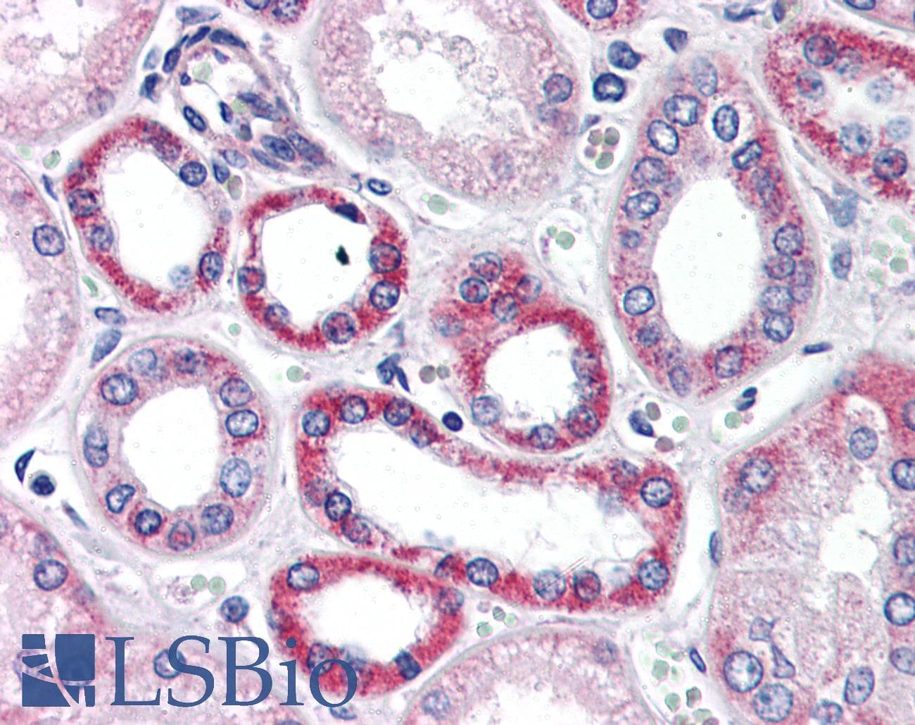 IHC-plus™ Polyclonal Rabbit anti-Human CCK4 / PTK7 Antibody (IHC, IF, WB)