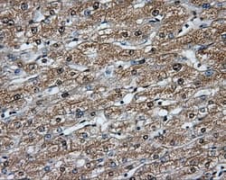 BTK Antibody (clone OTI12H4)