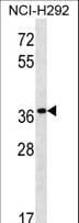 Polyclonal Rabbit anti-Human PGA5 / Pepsin A Antibody (aa354-383, WB)