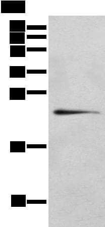 Polyclonal Rabbit anti-Human RILPL2 Antibody (IHC, WB)