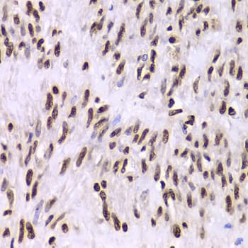 XRCC6 / Ku70 Antibody
