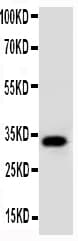 Polyclonal Rabbit anti-Human AQP10 / Aquaporin 10 Antibody (aa286-301, WB)
