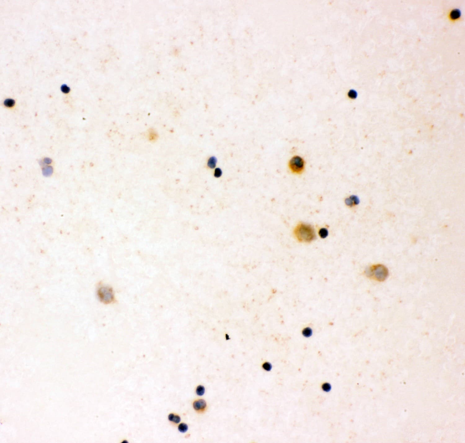 IL16 Antibody (aa1212-1332)