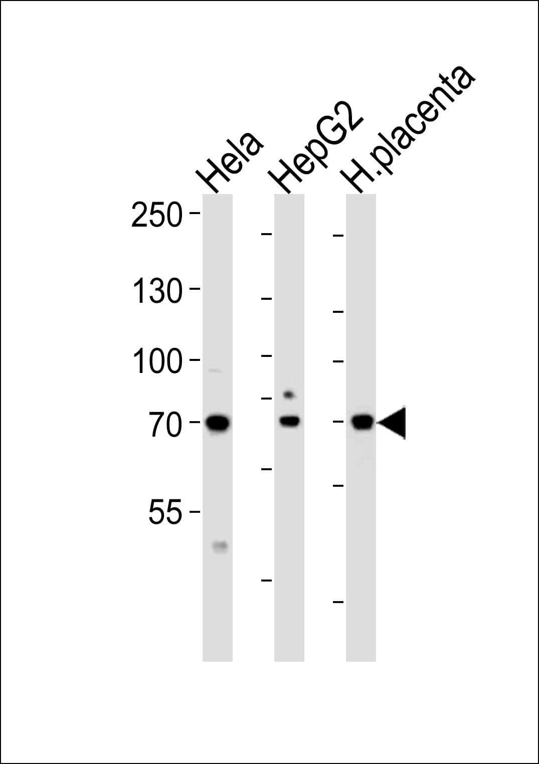 CREBL1 / ATF6B Antibody (aa560-589)
