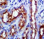 ABCB1 / MDR1 / P Glycoprotein Antibody (clone JSB-1)
