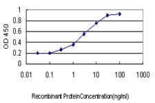 Monoclonal Mouse anti-Human SERPINB3 Antibody (clone 2F5, WB)