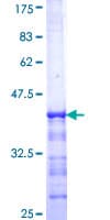 Human GRB14 Protein (Recombinant GST, N-terminus)