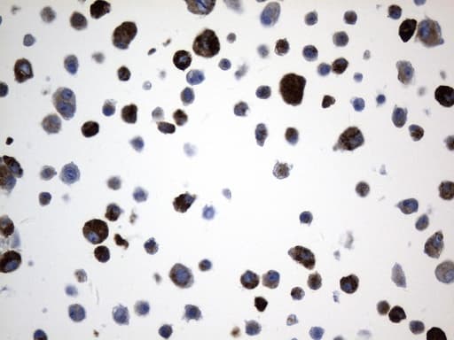 CD74 / CLIP Antibody (clone UMAB231)