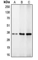 C/EBP Beta / CEBPB Antibody (Internal)