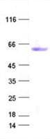 Human DES / Desmin Protein (Recombinant DDK,C-terminus)