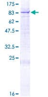 Human DHCR24 / Seladin-1 Protein (Recombinant GST)