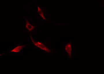 SEPT14 Antibody