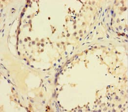 ZNF165 Antibody (aa1-485)