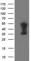 TMOD1 / Tropomodulin 1 Antibody (clone OTI7H3, Carrier-free)