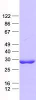 Human CSA / ERCC8 Protein (Recombinant His, N-Terminal)
