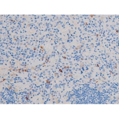 CDC25A Antibody (phospho-Ser178)