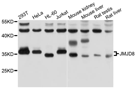 Polyclonal Rabbit anti-Human JMJD8 Antibody (WB)
