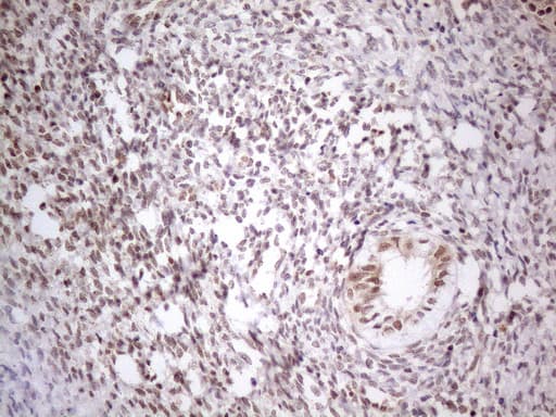 MED15 / ARC105 Antibody (aa393-679, clone OTI2C6)