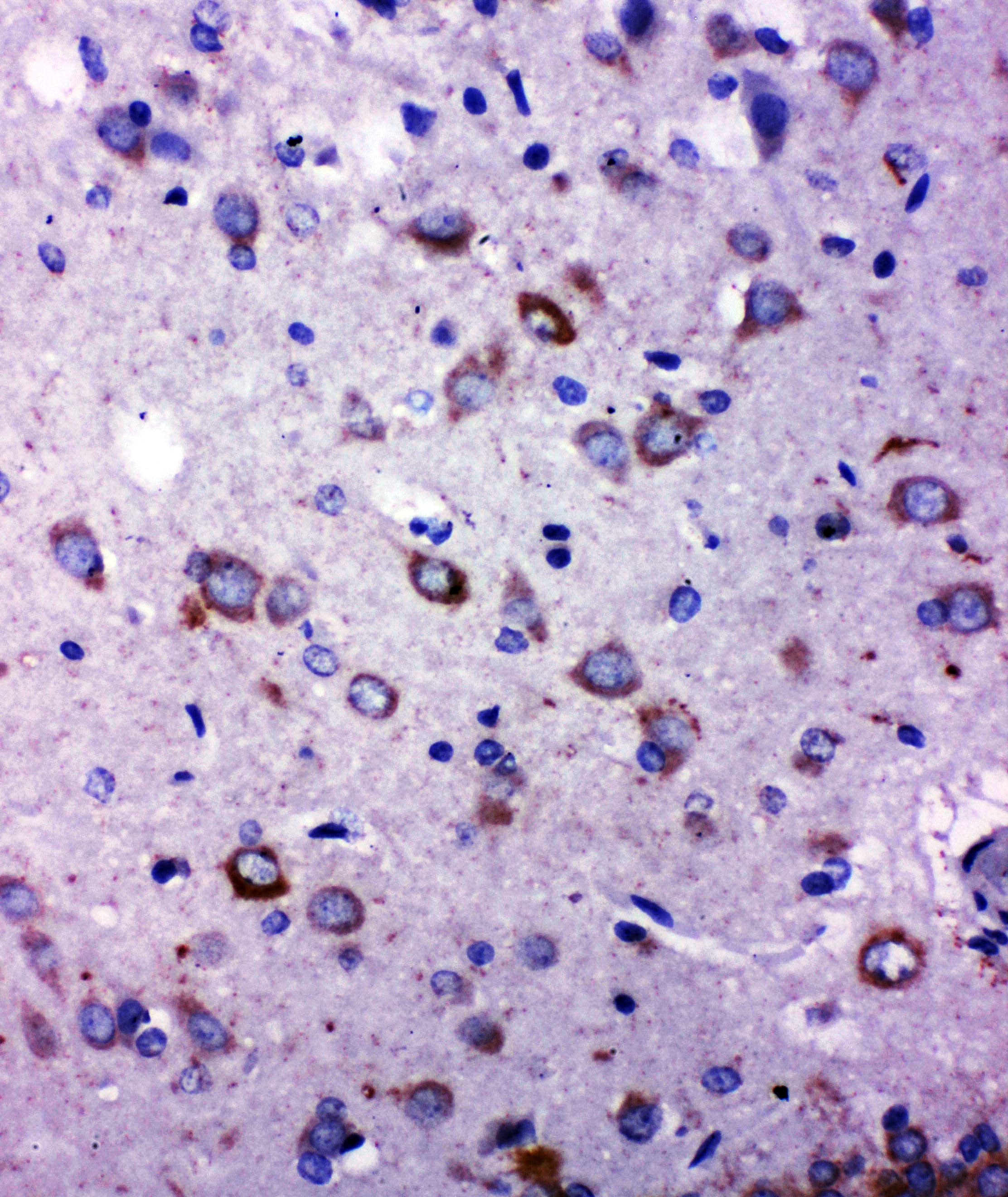 Polyclonal Rabbit anti-Human TRPC6 Antibody (aa249-265, IHC, WB)