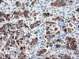 RPN1 / Ribophorin I Antibody (clone OTI6A9)