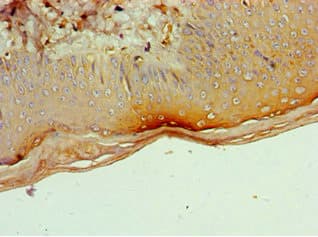 Polyclonal Rabbit anti-Human CD1A Antibody (aa21-181, WB)