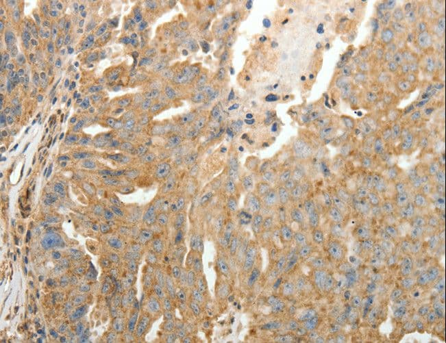 Polyclonal Rabbit anti-Human SFTPD / Surfactant Protein D Antibody (IHC)