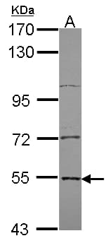 EDC3 Antibody (aa127-376)
