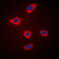 IHC-plus™ Polyclonal Rabbit anti-Human SCGB2A2 / Mammaglobin A Antibody (Internal, IHC, IF, WB)