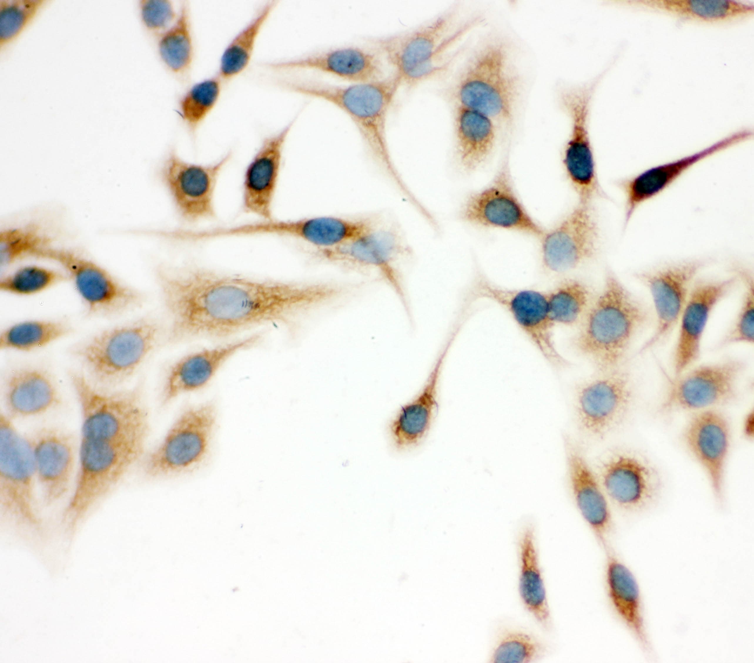 IDH2 Antibody (aa413-447)