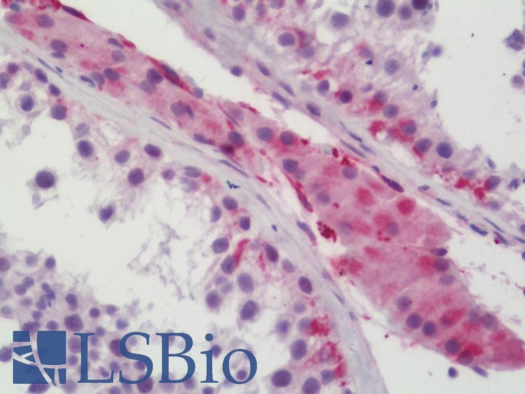 IHC-plus™ MEN1 / Menin Antibody (aa181-230)