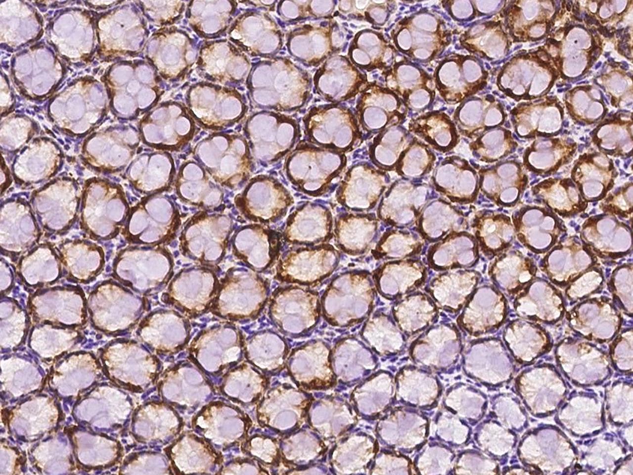 CTSE / Cathepsin E Antibody