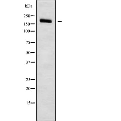 Polyclonal Rabbit anti-Human PDS5B / AS3 Antibody (WB)