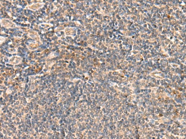 SEC22B Antibody