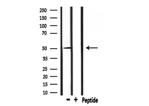 NR1H3 / LXR Alpha Antibody