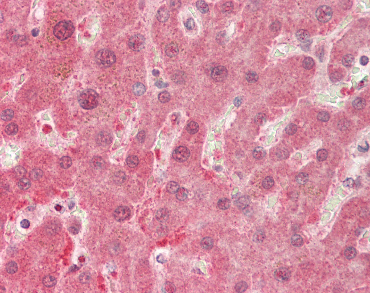 DDH / AKR1C1 Antibody (aa50-99)